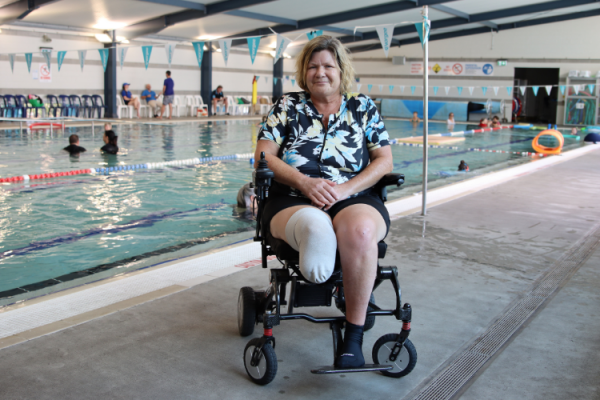 Transforming Lives with Hydrotherapy: Carol's Inspiring Amputee Rehabilitation Journey