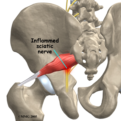 https://www.myhealthteam.com.au/media/img/729/piriformis_anatomy02.jpg