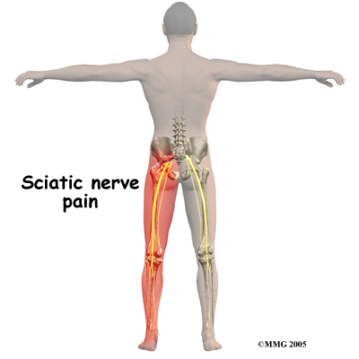 Finding Comfort: How to Sit with Piriformis Syndrome and Relieve Pain -  Kinetic Labs